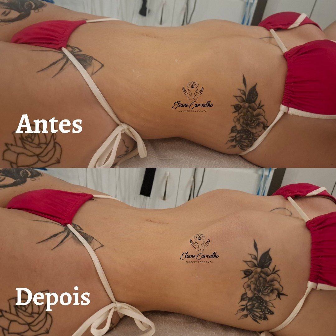 Corpoperfeito